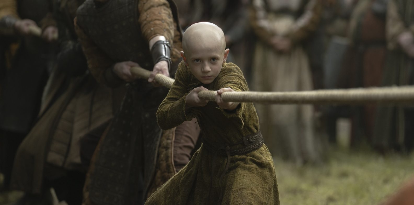 Why is Egg Bald? Did Dexter Sol Ansell Shave His Head for A Knight of the Seven Kingdoms?