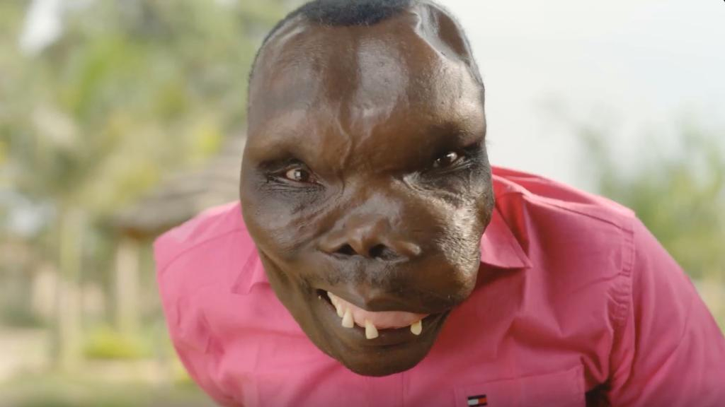 Godfrey Baguma: Where is the World’s “Ugliest” Man Now?