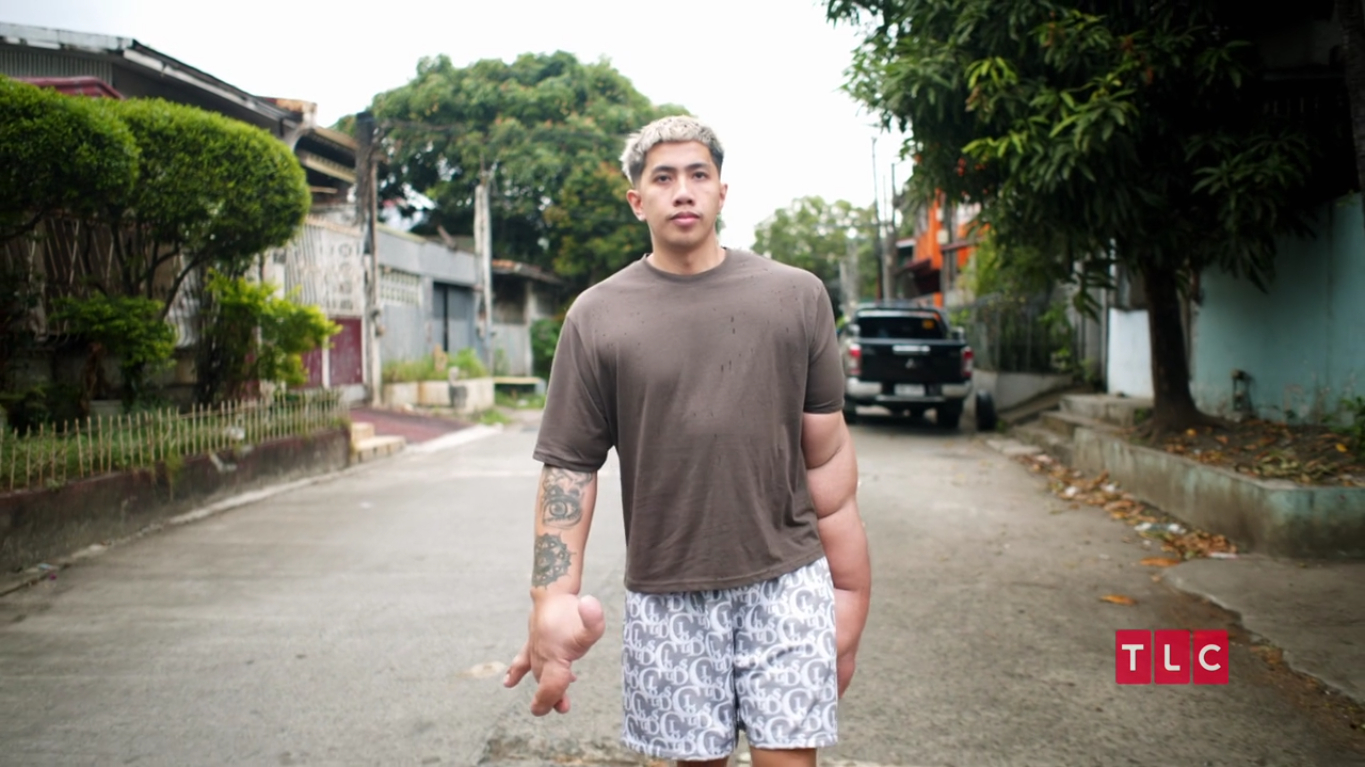 Mark Davidson Jacildo: Where is the Man with the Biggest Hands Now?